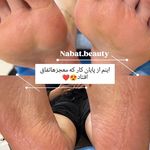 بافت موی لبخند - بافت - 2838