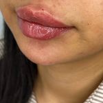 کلینیک زیبایی خانم محمدرضایی پوست ومو