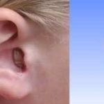 مرکز گوش و شنوایی غرب تهران