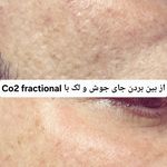 کلینیک زیبایی مرکز لیزر و لاغری زرین ماه