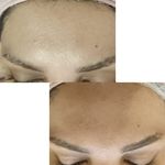 پاکسازی صورت فیشال تخصصی بانو