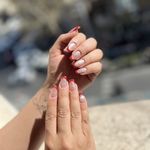 کاشت و ترمیم ستایش