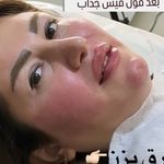 کلینیک زیبایی کاترین