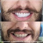 مطب دندان پزشکی لبخند شیرین