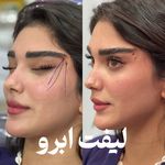 کلینیک لیزر و زیبایی دایان