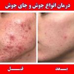 درمان تخصصی انواع عارضه پوست و مو