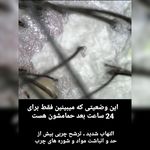 منصوره قهرمانی متخصص اسکراپ و اسکالپ سر