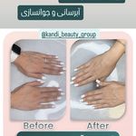 مرکز لیزر ،پوست و زیبایی کندی بیوتی