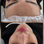 فیشیال و خدمات پاکسازی پوست الهام اورا