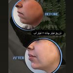 کلینیک زیبایی لاغری لیزر دانا