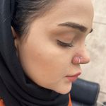 مرکز پیرسینگ،چال لپ و میکرودرمال ایدا