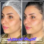 کلینیک پوست و مو بلانژ