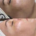 پاکسازی پوست و مو مهسام