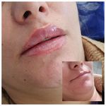 کیلینیک زیبایی الا
