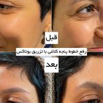 مرکز لیزر وکلینیک زیبایی پایون(بانوان)