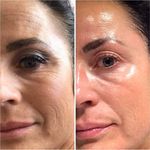 خدمات زیبایی،فیلر،نخ‌لیفت‌نانو،لاغری‌مزو