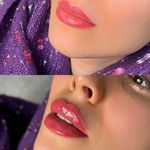 مرکز زیبایی پوست و مو آئورا (شعبه جردن)