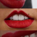 دندانپزشکی زیبایی دکتر محمد خسروی