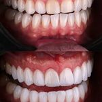 دندانپزشکی دکتر هومن باقری (بیمه نداریم)