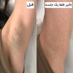 مرکز لیزر وکلینیک زیبایی پایون(بانوان)