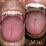 زبانشناسی سنوگرافی بدن از زبان میرحسینی