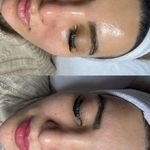 مرکز تخصصی پوست و فیشال نسترن احمدزاده