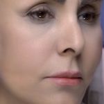 کلینیک زیبایی الماس کاملا اقساطی