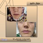 مطب پوست مو زیبایی فردوس شرق