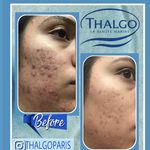 فیشیال و پاکسازی پوست تالگو فرانسه