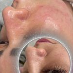 کلینیک فیشال و ماساژ سارن اسکین سارا