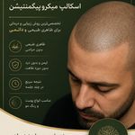 موسسه آموزش و درمان انواع ریزش مو ریشه