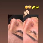 کلینیک فیشال و ماساژ سارن اسکین سارا