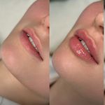 کلینیک تخصصی پوست و زیبایی ملینا