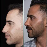 دکتر فرهاد محرابی سی سخت