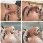 کلینیک زیبایی الماس کاملا اقساطی
