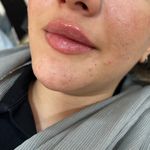 کلینیک ژل بوتاکس لیزر فیل بیوتی