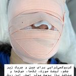خدمات پاکسازی و فیشیال