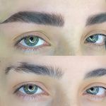 مرکز تخصصی فیبروز ابرو مژگان خناری