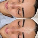 پاکسازی پوست و مو مهسام