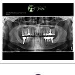 نوبت‌دهی آسان دکتر مراد هدایتی پناه، دندانپزشک و متخصص جراح لثه و ایمپلنت همدان - همدان - 5119