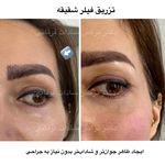 دکتر نرگس سادات فرقانی پوست مو زیبایی