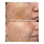 کلینیک زیبایی و لیزر مو زائد نوبا