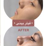 مطب زیبایی دکتر نلسا