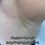 کلینیک زیبایی و لیزر نگین شرق