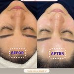 خدمات فیشیال و پاکسازی پوست