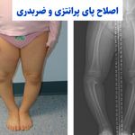 مرکز تخصصی حرکات اصلاحی و بدنسازی