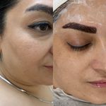 خدمات تخصصی فیشیال و مراقبتی پوست بارانا