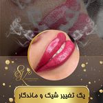 میکروکیماسی( میکروابرو چشم لب،ریمو)