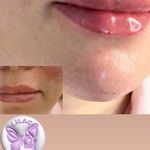 خدمات تخصصی پوست و مو لیلاک