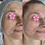 فیشال تخصصی معصومه قاسمی